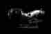 307-161-101 Weapon R Short Ram Intake